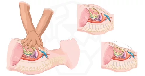 Online CPR: an effective solution